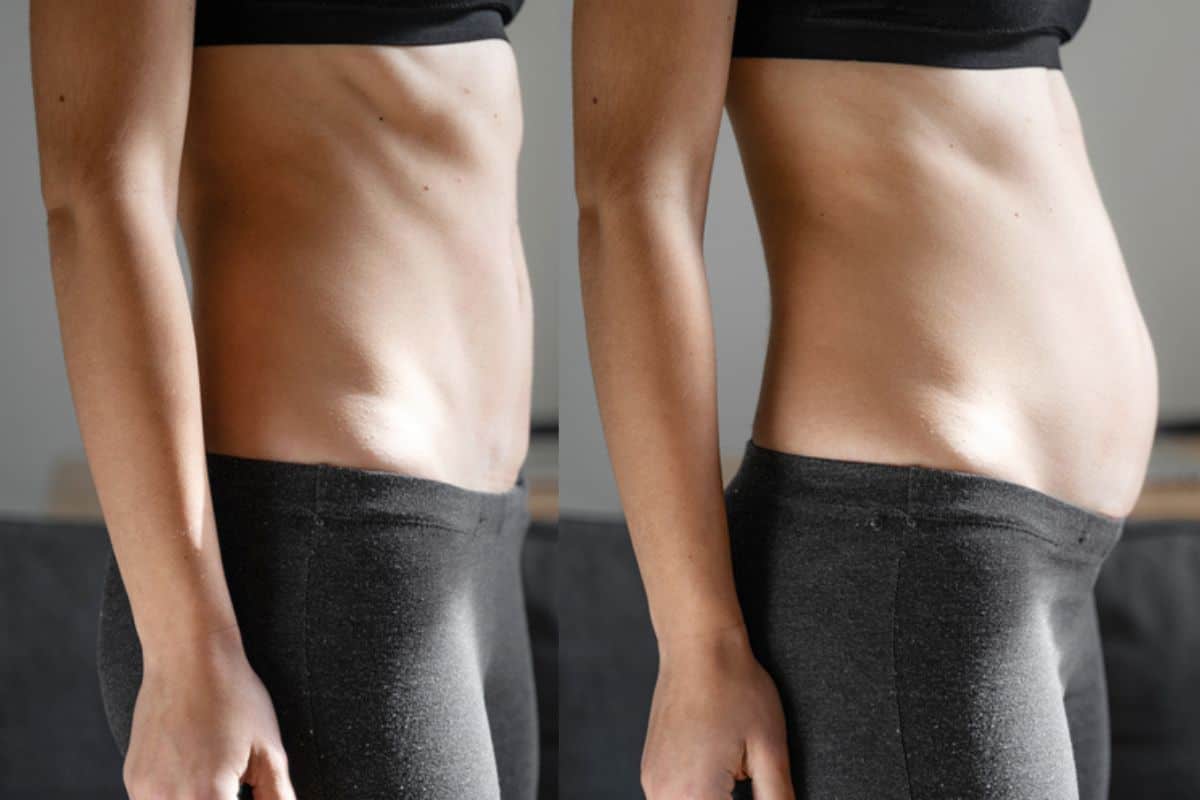 How long does diastasis recti take to improve Willenhall?