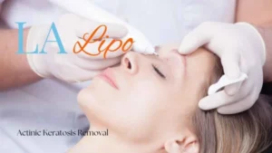 Woman receiving Actinic Keratosis Removal Treatment Willenhall