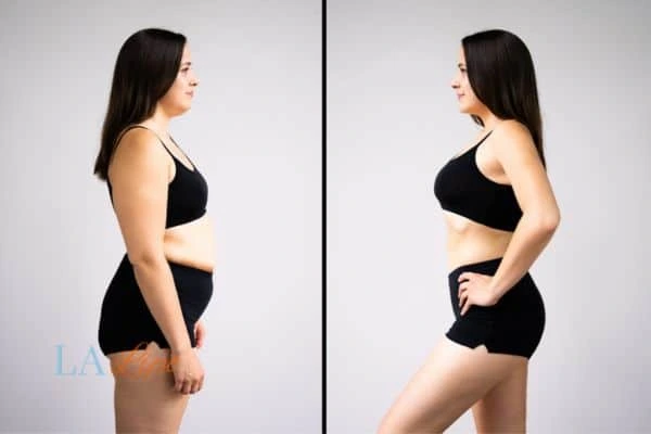LA-EMS Body Sculpting Willenhall results before and after of womans results on body toning.