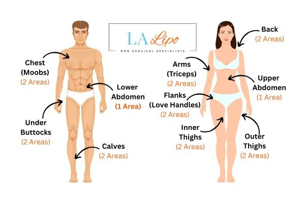 LA LIPO Cryolipolysis Areas Willenhall