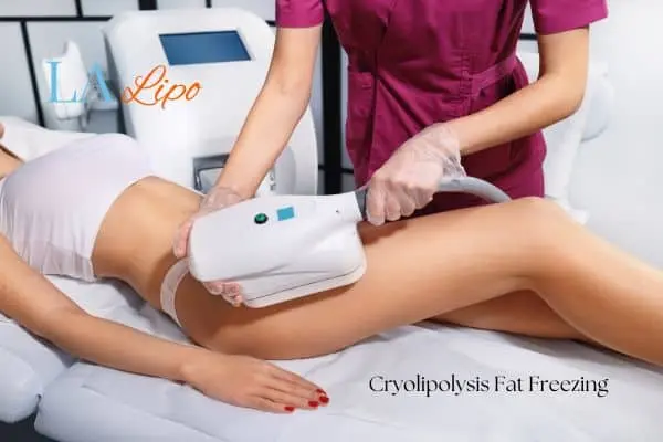 Woman receiving coolsculpting Willenhall treatment on her thighs