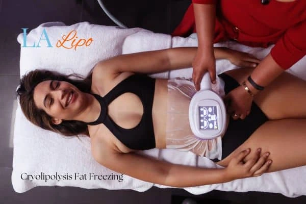 woman getting cryolipolysis Willenhall