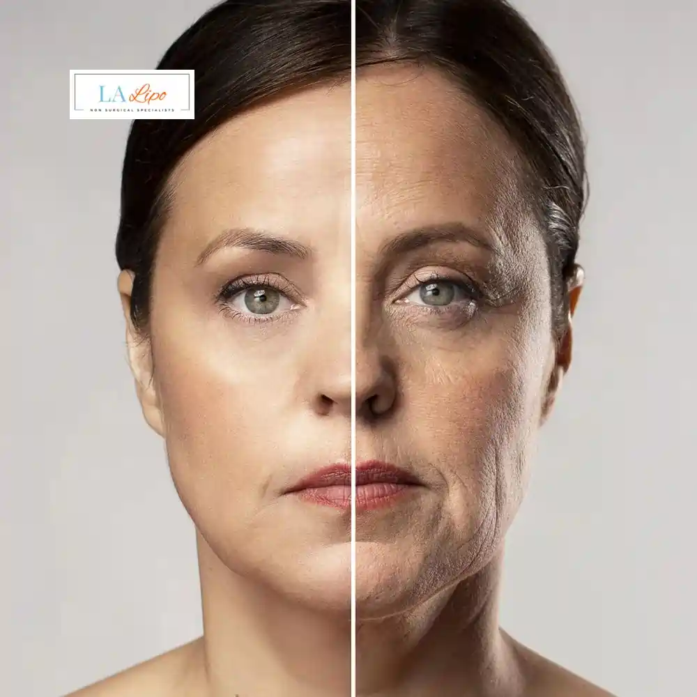How Can You Tell If Non-Surgical Skin Tightening Is Right for You Willenhall?
