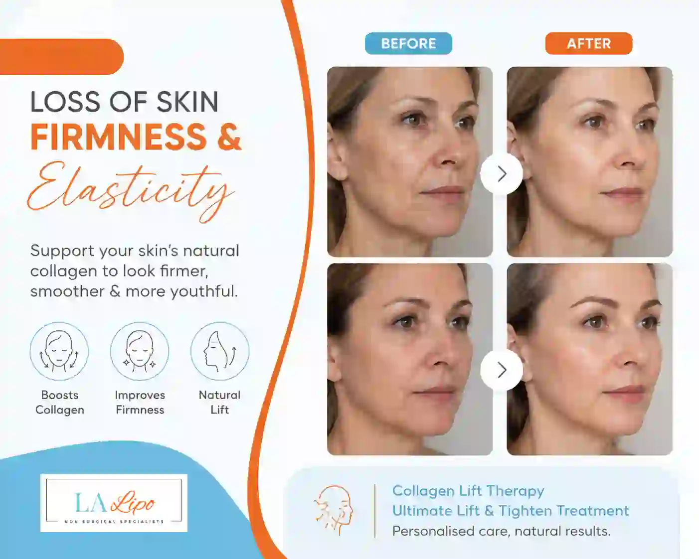 Sign #7: Loss of Skin Firmness and Elasticity Willenhall